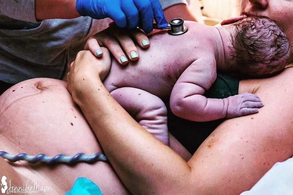 Siny kolor skóry noworodka w pierwszych sekundach po narodzinach